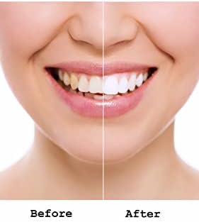 Омекотители за устата и паста за зъби Meridol Advantage Pack (2X75 мл + 100 мл за изплакване), 250 мл, 8,45